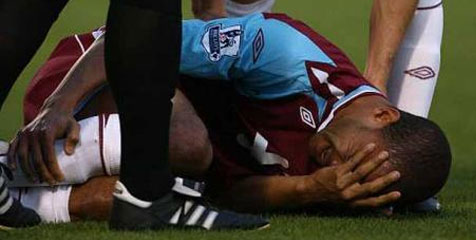 Kieron Dyer