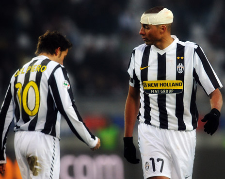 Skuad Juve Bakal DirombakTotal Skuad Juve Bakal DirombakTotal