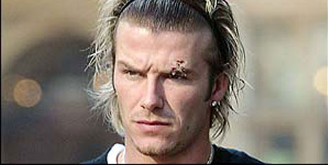 Beckham Bahas Insiden Sepatu Bot Fergie