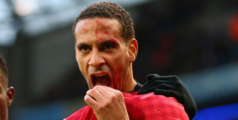 Rio Ferdinand Hampir Kehilangan Matanya