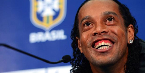 Ronaldinho Lakukan Operasi Guna Percantik Giginya