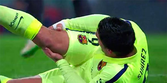 Dilanggar Keras, Kaki Suarez Robek dan Berdarah