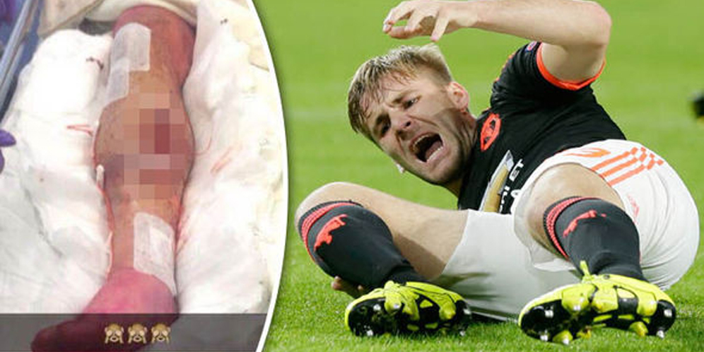 Inikah Foto Cedera Horror Luke Shaw? 