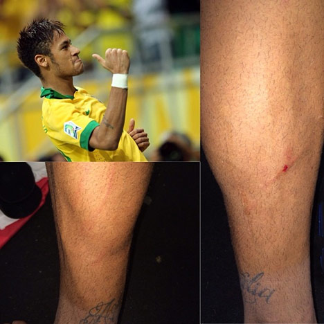 Luka di kaki Neymar (c) Instagram/neymarjr