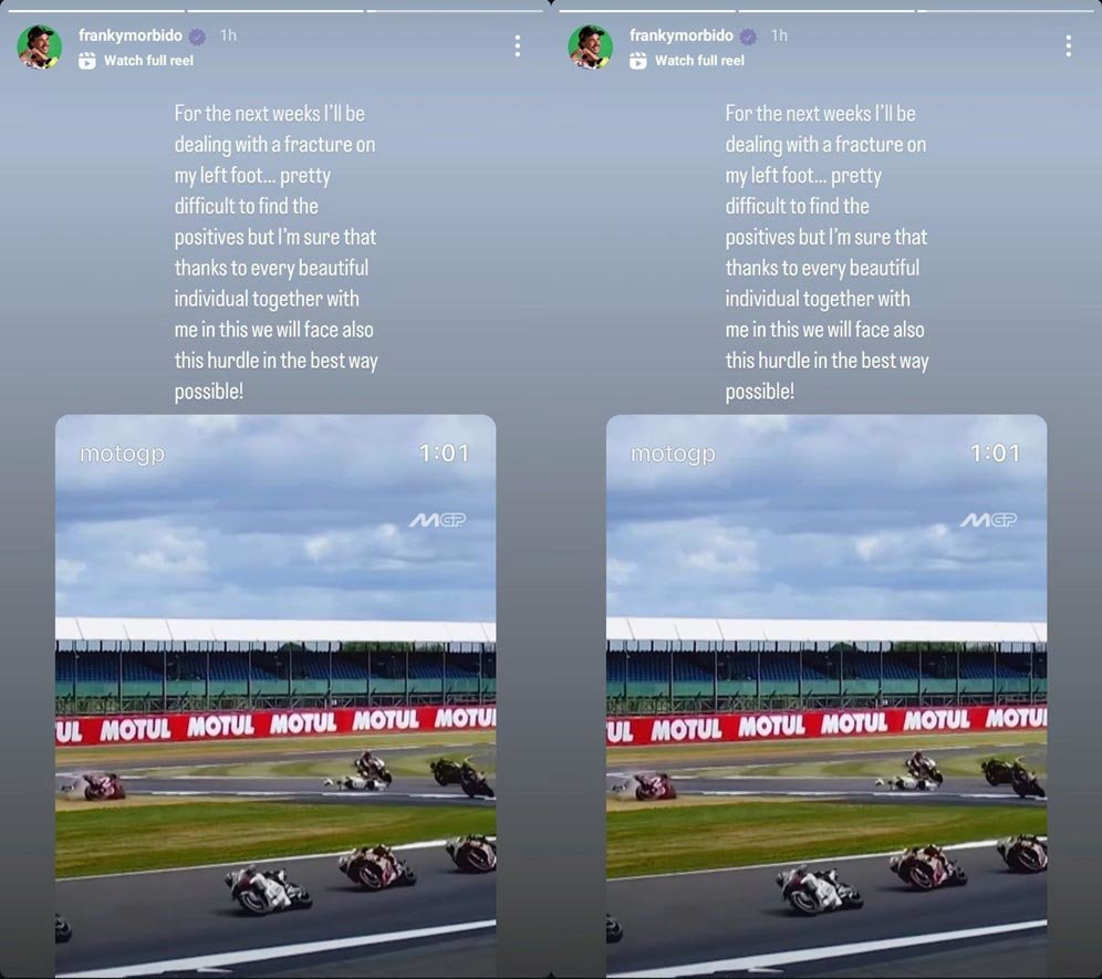 Franco Morbidelli mengumumkan cedera kaki usai tertabrak Aleix Espargaro di MotoGP Inggris 2025. (c) Instagram/FrankyMorbido