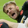 Luke Shaw Kembali Berlatih, Ini Kondisi Kakinya