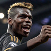 Rambut Baru, Kepala Pogba Mirip Partitur Musik 