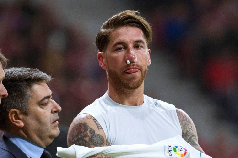 Beginilah Penampakan Hidung Sergio Ramos Setelah Patah