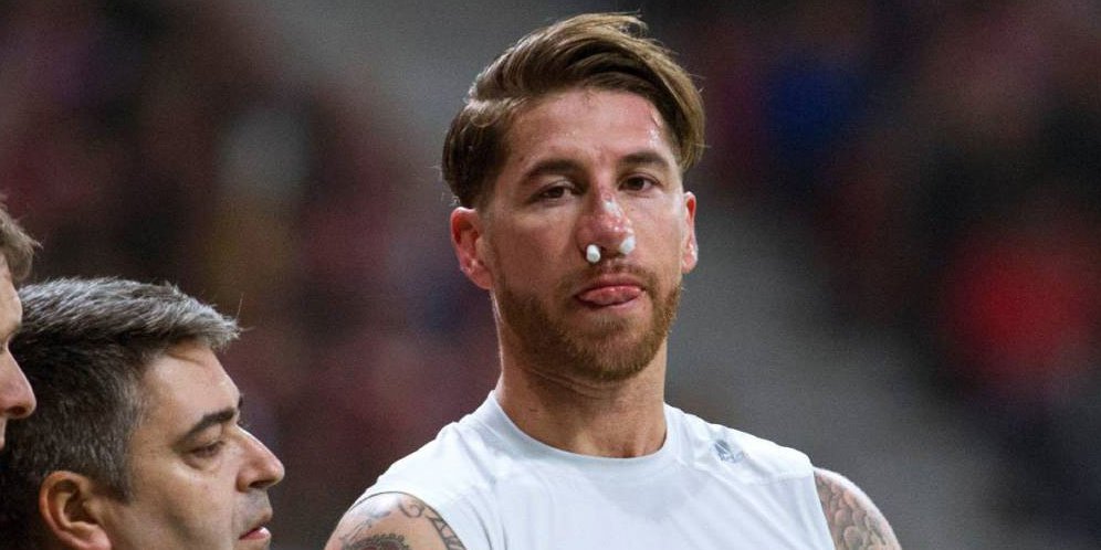 Beginilah Penampakan Hidung Sergio Ramos Setelah Patah