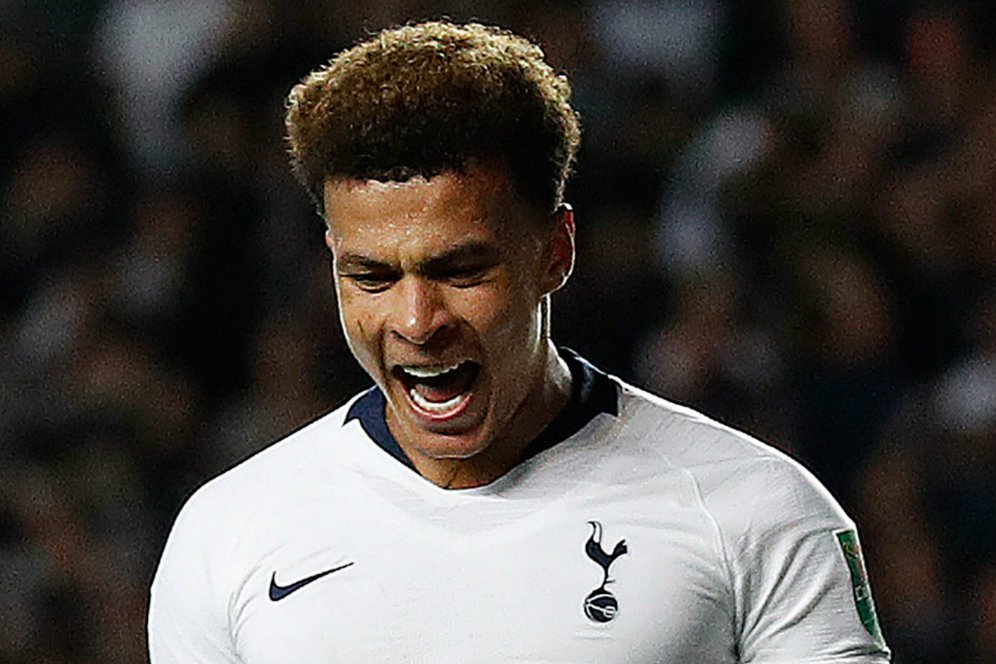 Resmi, Dele Alli Tidak Bisa Perkuat Tottenham Lawan Manchester United