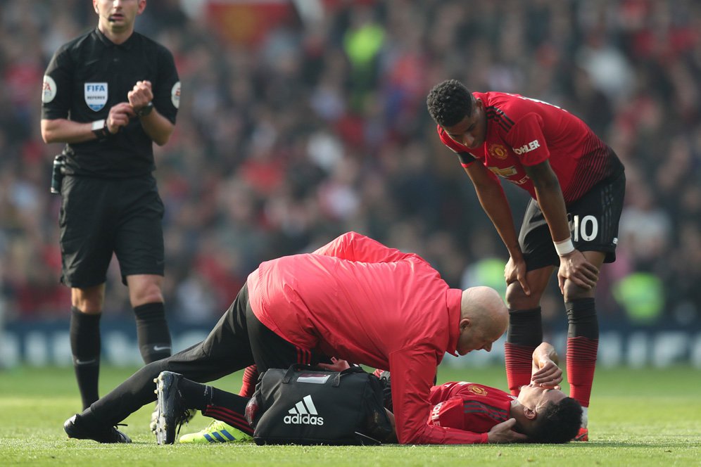 Saran Keown untuk Lingard: Jangan Memaksa Bermain kalau Cedera