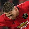 Cedera, Scott McTominay Absen Satu Bulan?