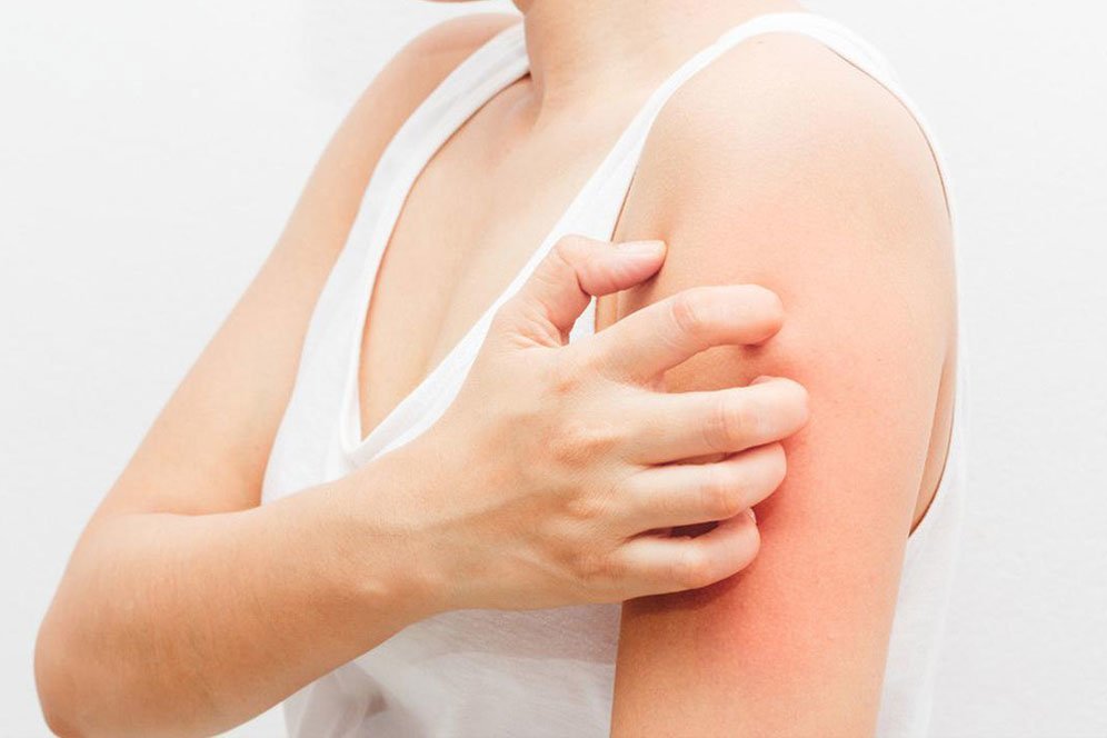 Jenis-Jenis Penyakit Kulit dan Cara Mengatasinya Secara Alami Jenis-Jenis Penyakit Kulit dan Cara Mengatasinya Secara Alami