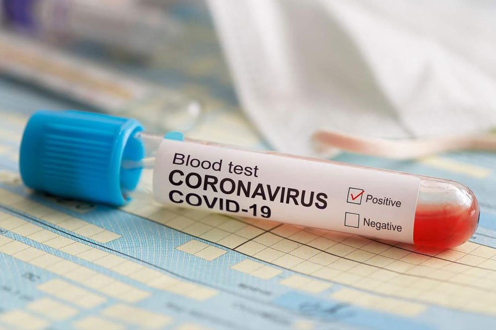 Apa Itu Rapid Test Covid-19 untuk Deteksi Virus Corona?