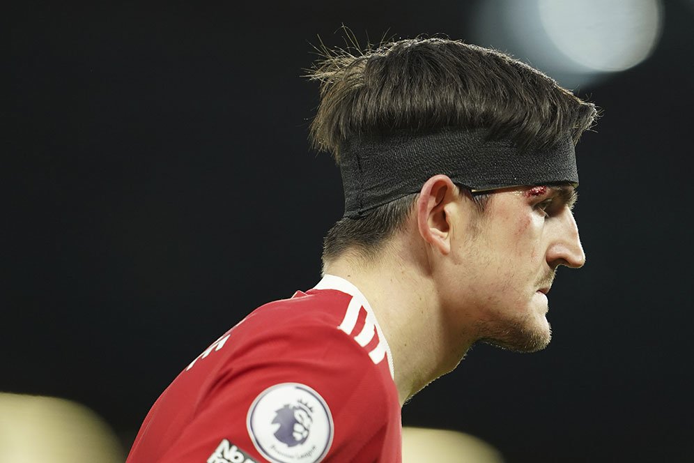 5 Pemain yang Bisa Menggantikan Harry Maguire Sebagai Kapten MU