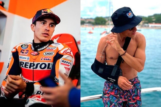 Tetap Prioritaskan Kesehatan Marc Marquez