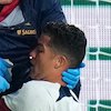 Tabrakan dengan Kiper Ceko, Hidung Ronaldo Berdarah