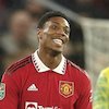 Duh, Anthony Martial Cedera Lagi