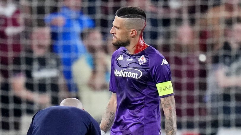 Insiden Kepala Kapten Fiorentina Berdarah Nodai Gelar Juara West Ham