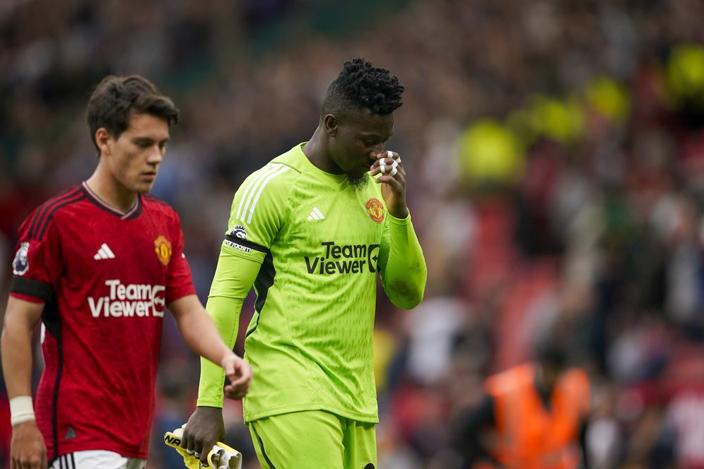 Termasuk Andre Onana, Ini Lima Pemain Terburuk Manchester United pada 5 Pekan Pertama Premier League 2023/2024