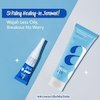 Spesial dan Eksklusif di Shopee Finest! ERHA Luncurkan Produk Acneact Trial Kit untuk Atasi Jerawat