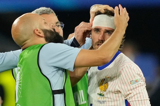 Antoine Griezmann memakai perban di kepalanya dalam laga Euro 2024 antara Austria vs Prancis, Selasa (18/6/2024). (c) AP Photo/Andreea Alexandru