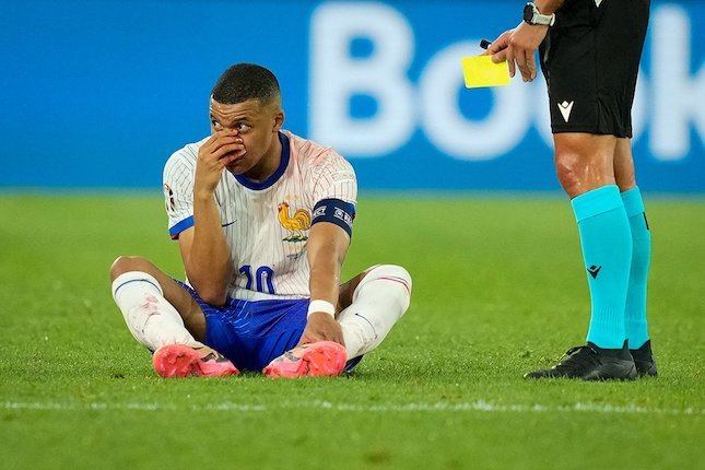 Insiden patah hidung Kylian Mbappe di laga Austria vs Prancis, Euro 2024 (c) AP Photo/Andreea Alexandru