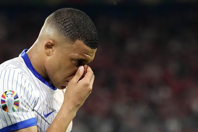 Kylian Mbappe mengalami cedera hidung pada laga Euro 2024 (c) AP Photo/Martin Meissner