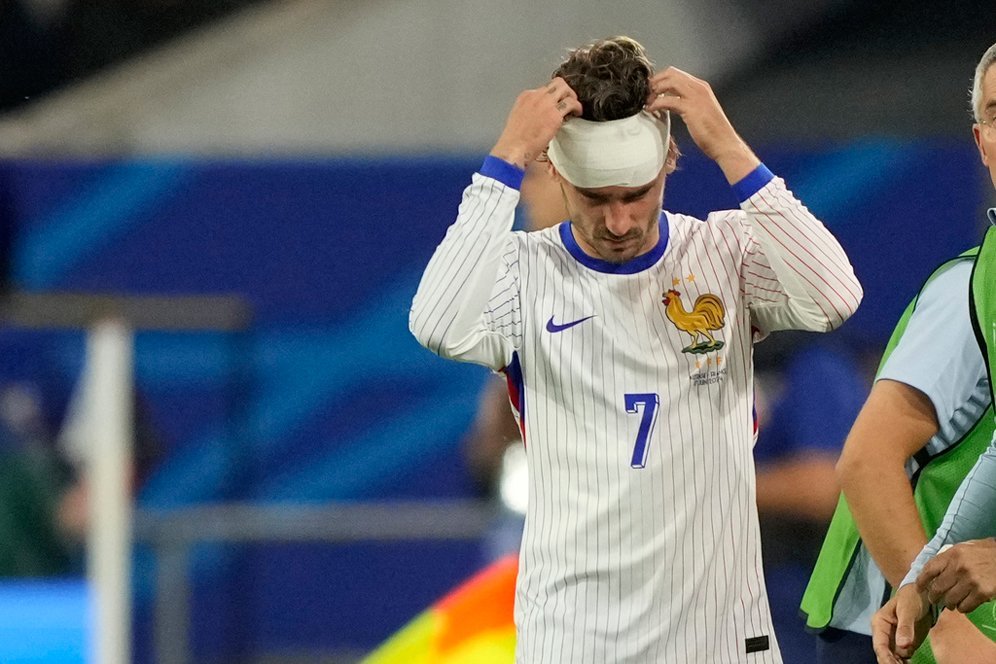 Petaka Prancis di Euro 2024: Kylian Mbappe Patah Hidung, Kepala Antoine Griezmann Bocor Terhantam Papan Iklan Petaka Prancis di Euro 2024: Kylian Mbappe Patah Hidung, Kepala Antoine Griezmann Bocor Terhantam Papan Iklan