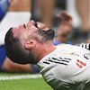 Xabi Alonso Pusing! Madrid Kehilangan Carvajal dan Alexander-Arnold Sekaligus