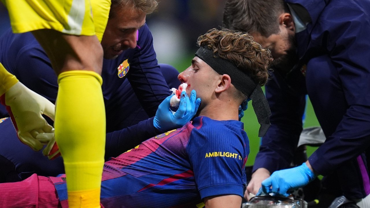 Ngilu! Cedera Horor Dialami Fermin Lopez di Laga Atletico Madrid vs Barcelona, Wajahnya Sampai Berdarah