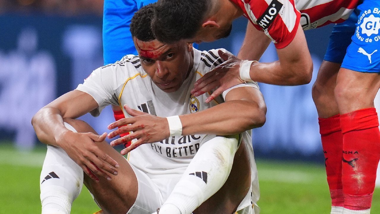 Kontroversi dari Kekalahan Real Madrid: Mbappe Disikut Sampai Berdarah, tapi VAR Hanya Diam Kontroversi dari Kekalahan Real Madrid: Mbappe Disikut Sampai Berdarah, tapi VAR Hanya Diam