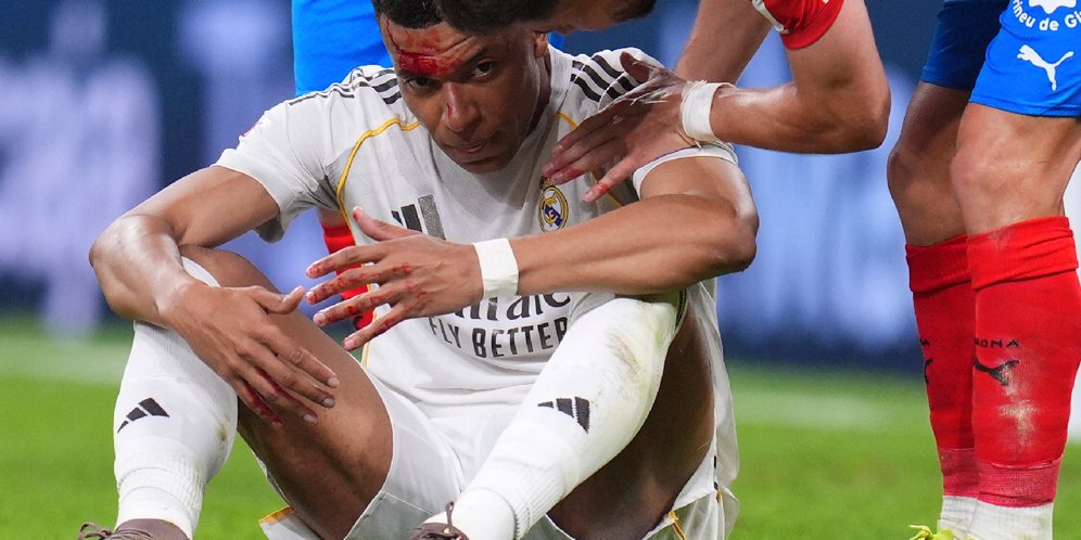 Kontroversi dari Kekalahan Real Madrid: Mbappe Disikut Sampai Berdarah, tapi VAR Hanya Diam