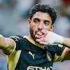 Hasil Pramusim Man City vs Atletico Madrid: Comeback 3-1, Omar Marmoush Cetak 2 Gol Hasil Pramusim Man City vs Atletico Madrid: Comeback 3-1, Omar Marmoush Cetak 2 Gol