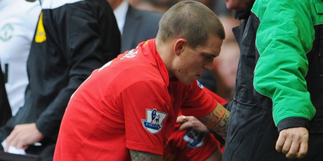 Cedera Agger Tak Separah Yang Diperkirakan