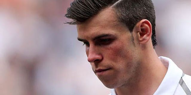 Madrid Konfirmasi Bale Tak Derita Cedera Aneh