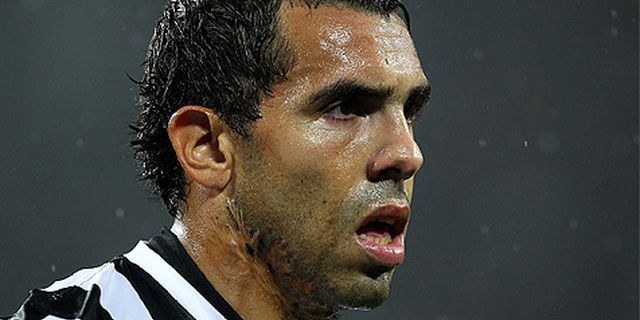 Tevez Tidak Terganggu Dengan Bekas Luka di Wajahnya