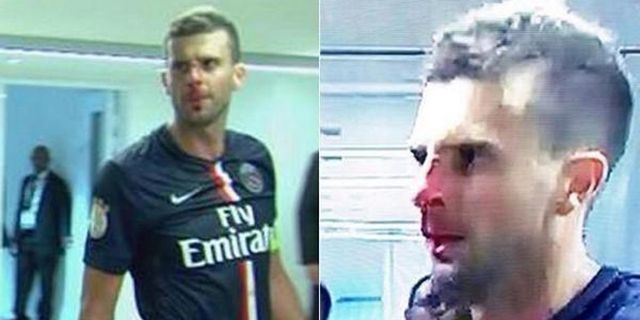 Video: Perkelahian Usai Laga Berujung Patahnya Hidung Thiago Motta