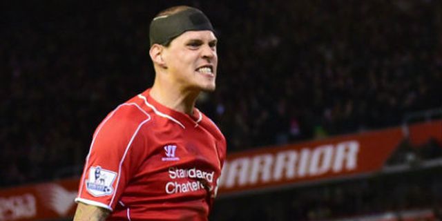 Skrtel Pamerkan Luka Horor Bekas Injakan Giroud