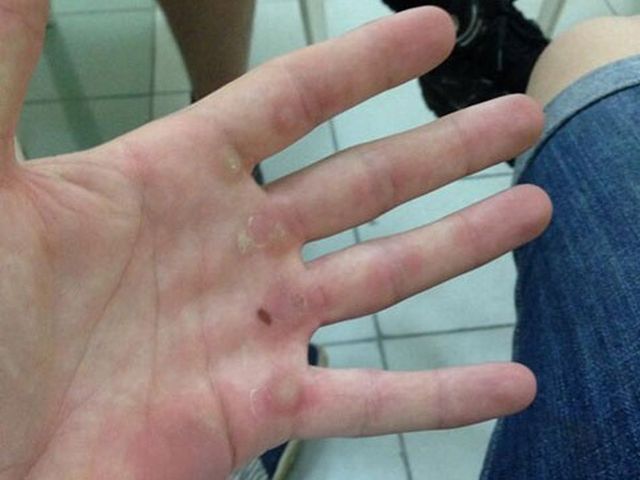 Uji Coba Di Malaysia Para Pebalap Motogp Luka Luka Bola Net