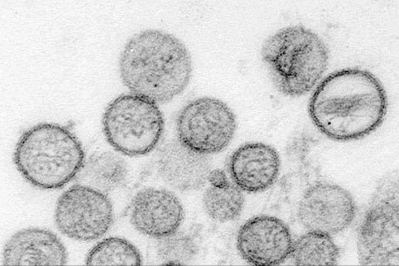 Mengenal Hantavirus, Virus Baru yang Mengancam Dunia Setelah Virus Corona