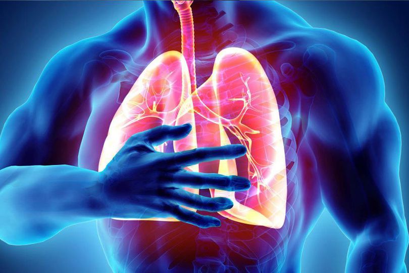 Penting: Kenali Penyebab, Gejala, dan Cara Pencegahan Penyakit Pneumonia