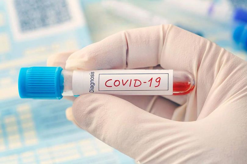 Penting, Pahami Cara Kerja Rapid Test Virus Corona