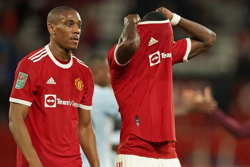 Anthony Martial Ingin Cabut dari MU, Ralf Rangnick: Silakan Saja, Tapi...