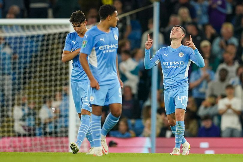 Pengakuan Guardiola, Manchester City Kalah Firepower!