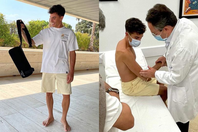 6 Pekan Diobservasi, Marc Marquez Resmi Diizinkan Fisioterapi Lengan