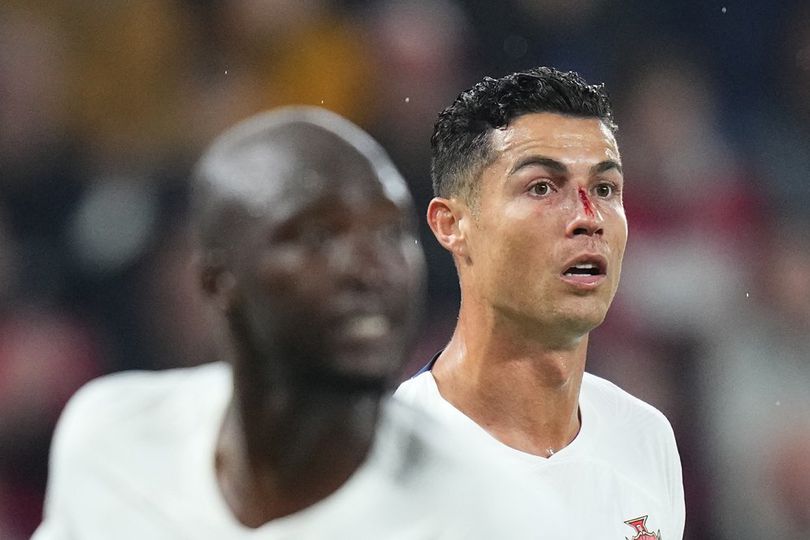 Perjuangan Cristiano Ronaldo Lawan Ondrej Kudela Dkk: Gagal Bikin Gol, Berdarah-darah!