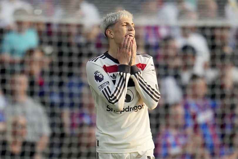 Setelah Alejandro Garnacho, 2 Pemain MU Dikonfirmasi Alami Cedera Setelah Alejandro Garnacho, 2 Pemain MU Dikonfirmasi Alami Cedera