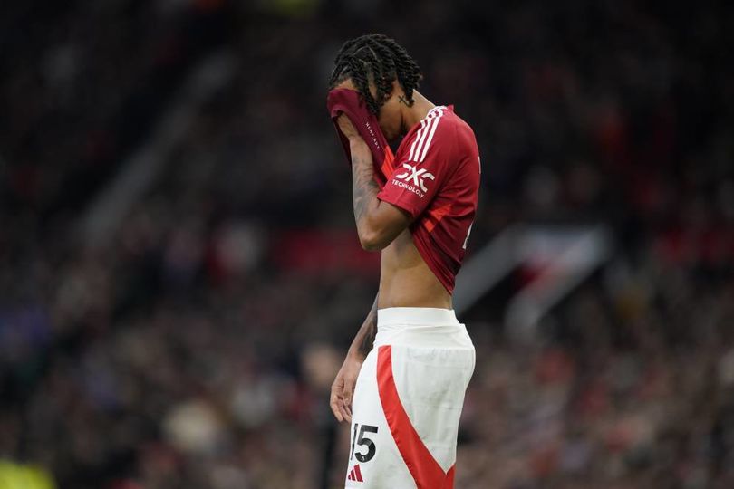 Gawat! Cedera Leny Yoro Jadi Pukulan Berat Jelang Final Liga Europa, MU Waswas Gawat! Cedera Leny Yoro Jadi Pukulan Berat Jelang Final Liga Europa, MU Waswas