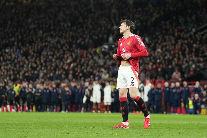 Pesan Perpisahan Emosional Victor Lindelof: 8 Tahun yang Indah dan Sebuah Janji Abadi untuk MU Pesan Perpisahan Emosional Victor Lindelof: 8 Tahun yang Indah dan Sebuah Janji Abadi untuk MU
